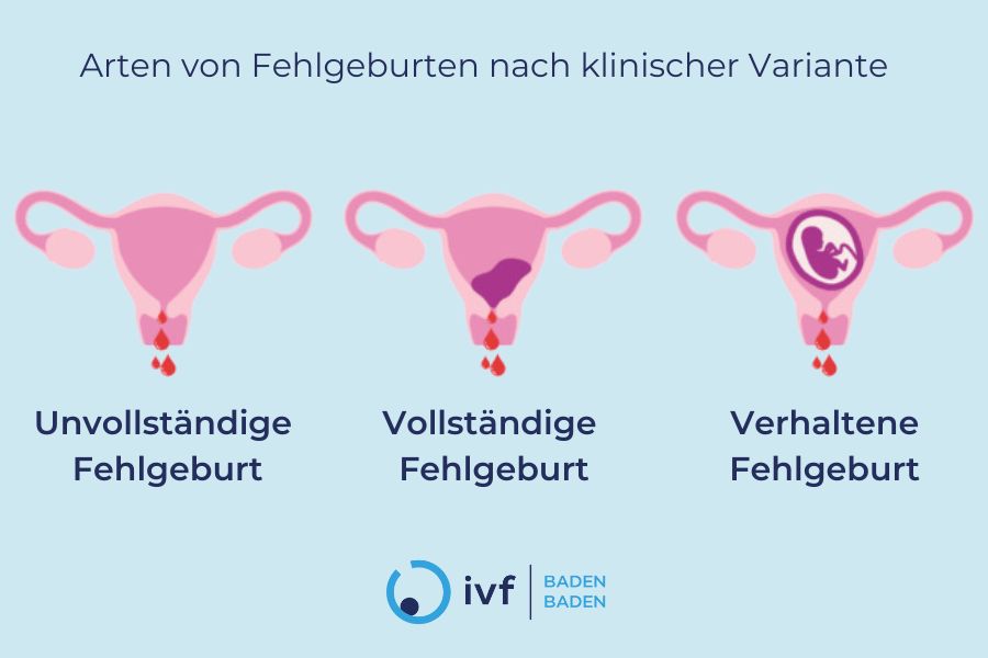 wiederholte-fehlgeburten-wie-l-sst-sich-das-abortrisiko-minimieren